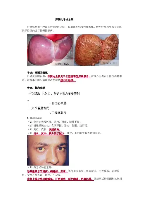 肝硬化考点总结