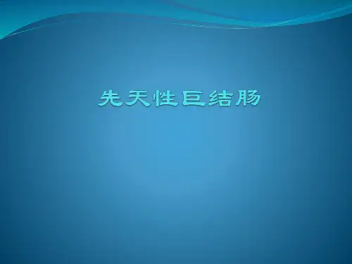 先天性巨结肠