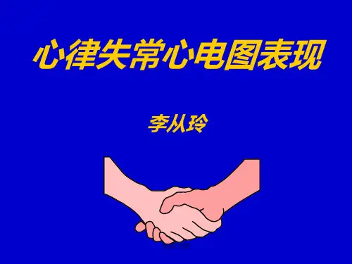 心律失常心电图表现