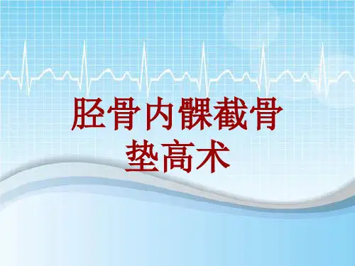 手术讲解模板：胫骨内髁截骨垫高术