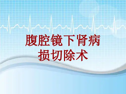 手术讲解模板：腹腔镜下肾病损切除术