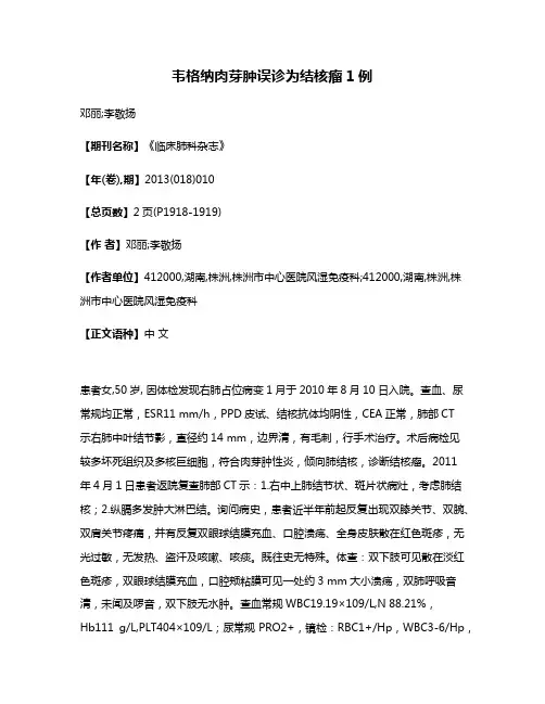 韦格纳肉芽肿误诊为结核瘤1例