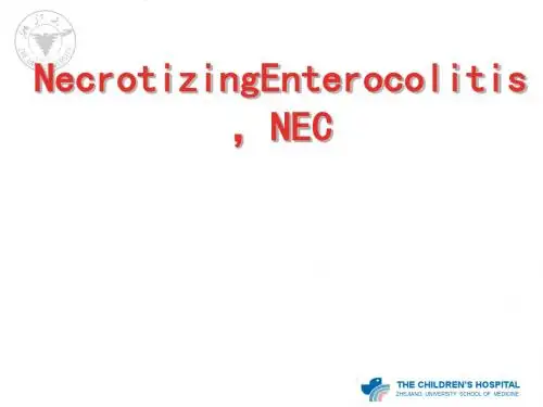 NEC(新生儿坏死性小肠结肠炎)