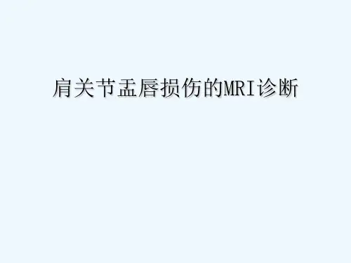 肩关节盂唇损伤的MRI诊断 PPT