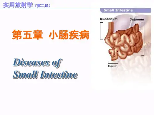 【课件X线】小肠疾病