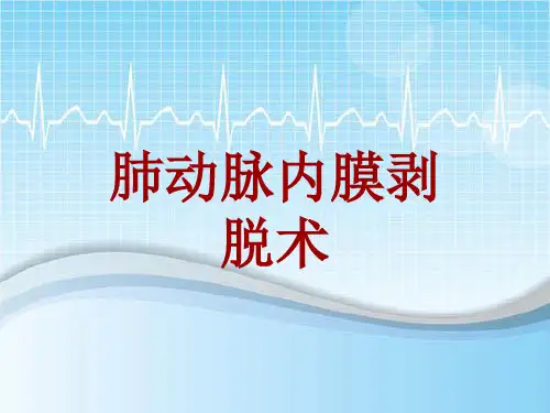 手术讲解模板：肺动脉内膜剥脱术