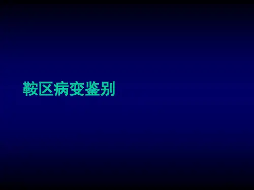 鞍区病变鉴别