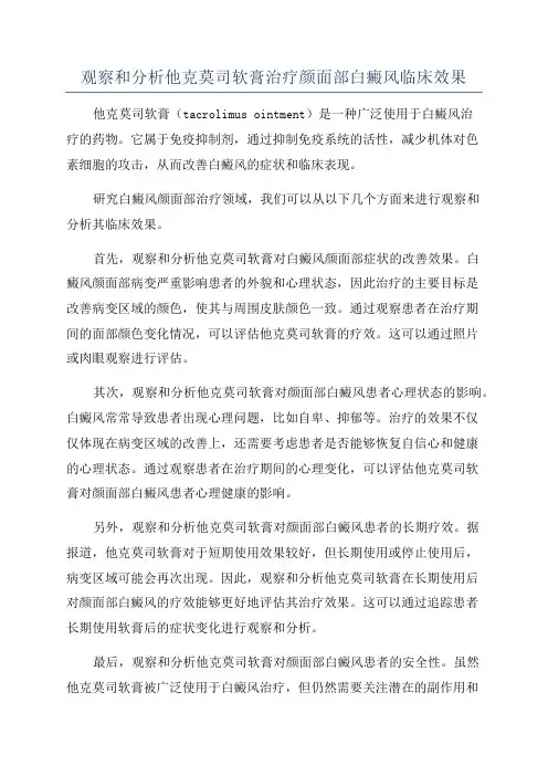 观察和分析他克莫司软膏治疗颜面部白癜风临床效果