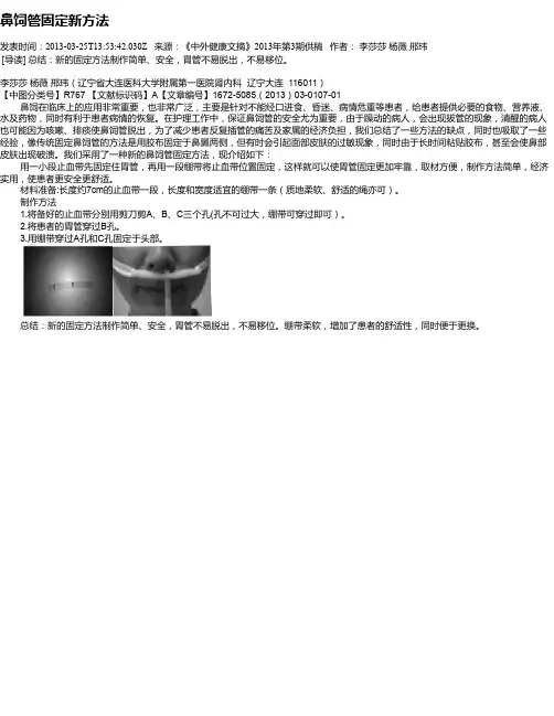 鼻饲管固定新方法