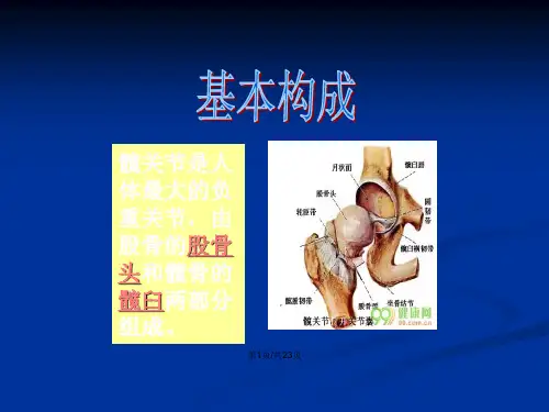 全髋关节置换术后护理查房