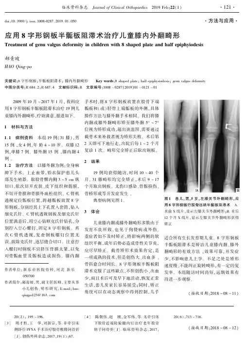 应用8字形钢板半骺板阻滞术治疗儿童膝内外翻畸形