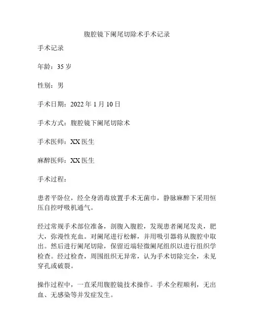 腹腔镜下阑尾切除术手术记录