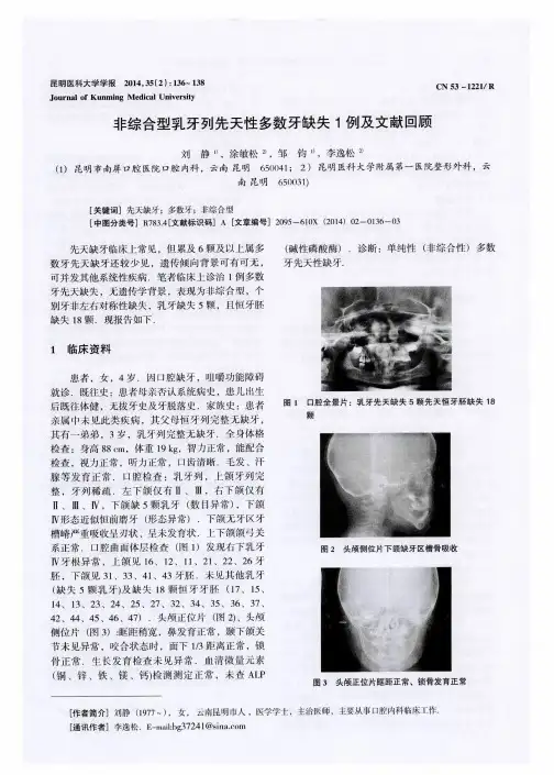 非综合型乳牙列先天性多数牙缺失1例及文献回顾