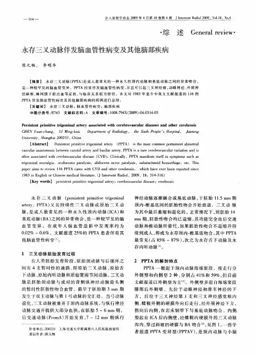 永存三叉动脉伴发脑血管性病变及其他脑部疾病