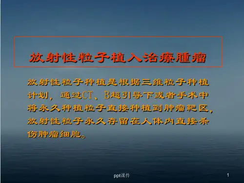放射性粒子植入治疗肿瘤  ppt课件