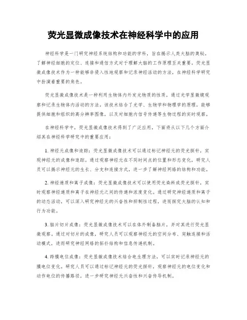 荧光显微成像技术在神经科学中的应用