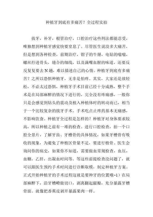 种植牙到底有多痛苦？全过程实拍