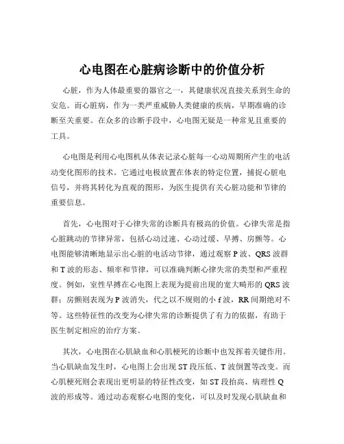 心电图在心脏病诊断中的价值分析