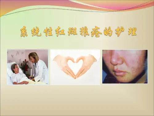 系统性红斑狼疮的护理ppt医学课件