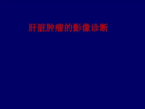 肝脏肿瘤的影像诊断PPT