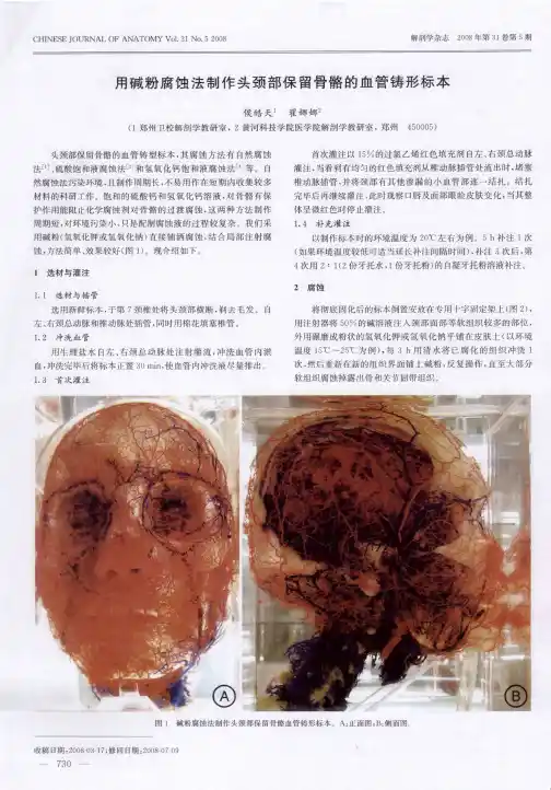 用碱粉腐蚀法制作头颈部保留骨骼的血管铸形标本