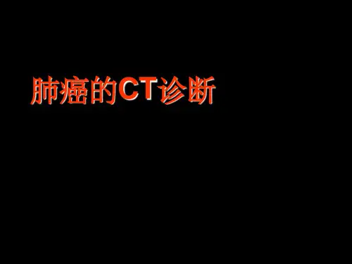 肺癌的CT诊断