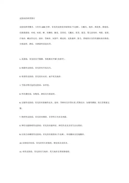 皮肤病的种类图片