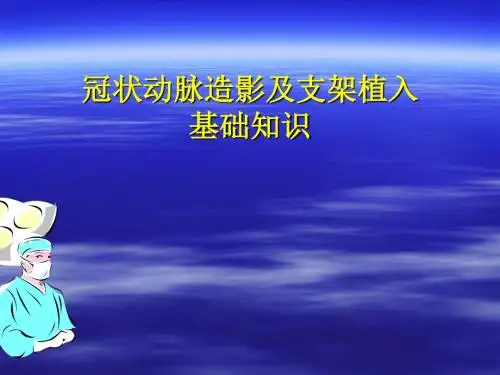 冠状动脉造影及支架植入基础知识.ppt;ppt