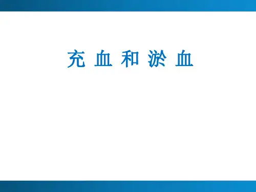 充血和淤血