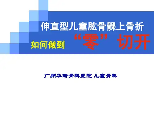 伸直型儿童肱骨髁上骨折PPT课件