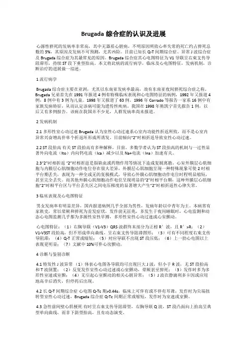 Brugada综合症的认识及进展