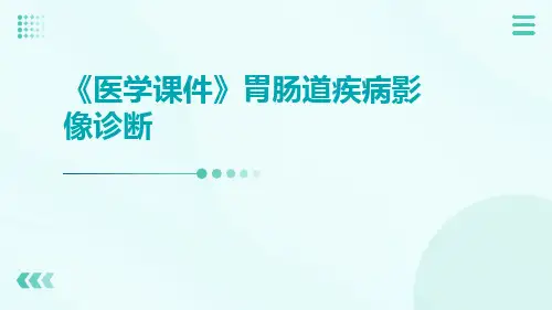 (医学课件)胃肠道疾病影像诊断
