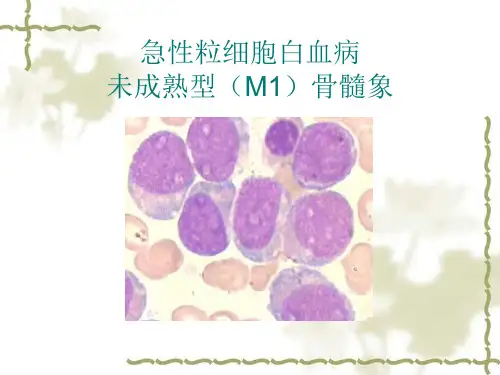 急性白血病图谱PPT课件