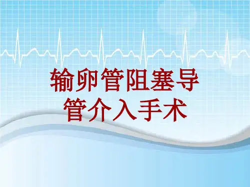 手术讲解模板：输卵管阻塞导管介入手术