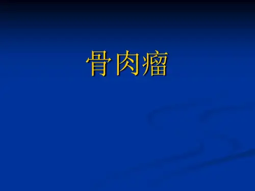 骨肉瘤PPT医学课件