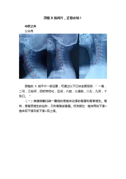 颈椎X线阅片，正骨必知！