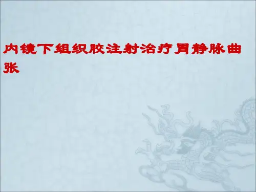 内镜下组织胶注射