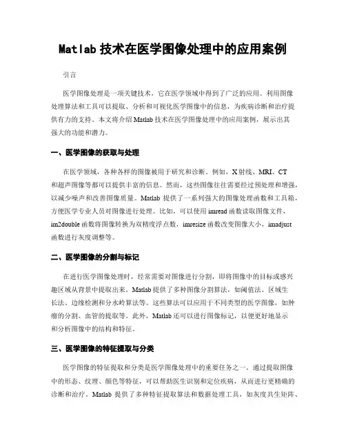 Matlab技术在医学图像处理中的应用案例