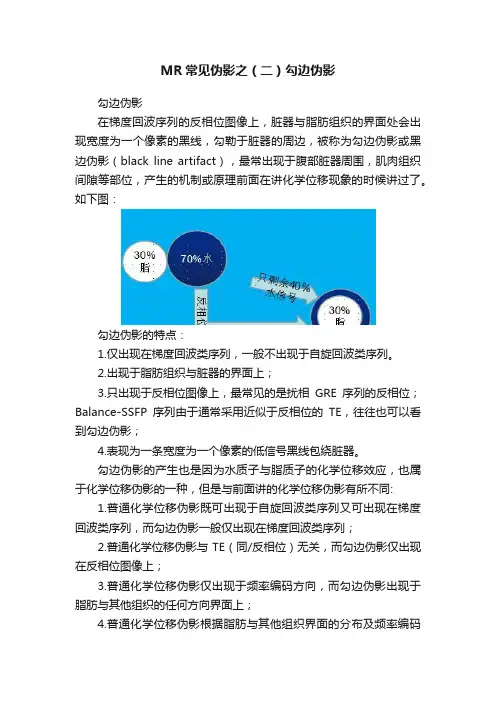MR常见伪影之（二）勾边伪影