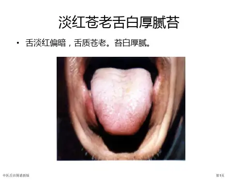 中医舌诊图谱新版专家讲座