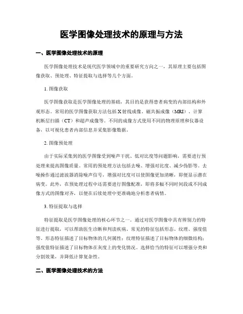 医学图像处理技术的原理与方法