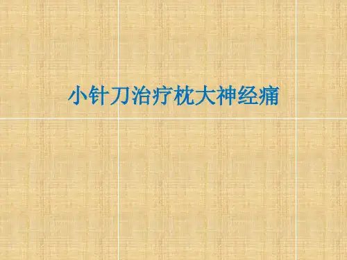小针刀治疗枕大神经痛