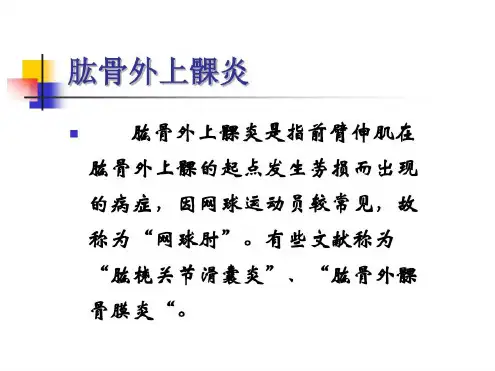 肱骨外上髁炎-2022年学习资料