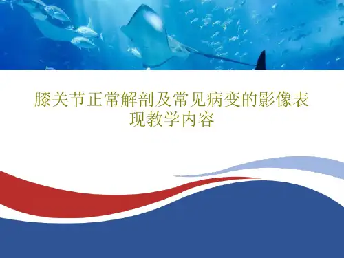膝关节正常解剖及常见病变的影像表现教学内容95页PPT