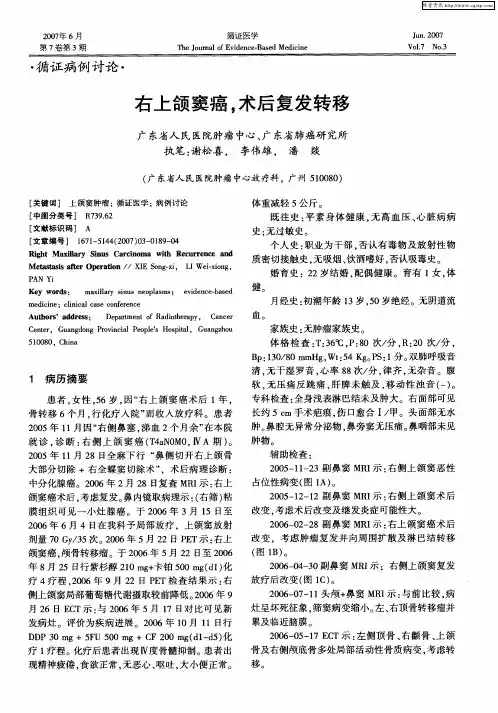 右上颌窦癌,术后复发转移