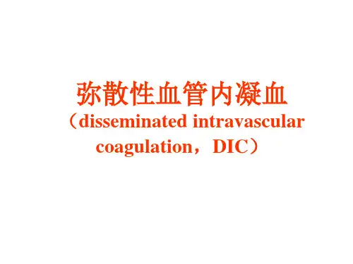 病理生理学--DIC