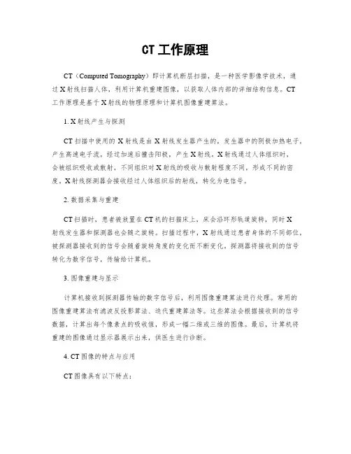 CT工作原理