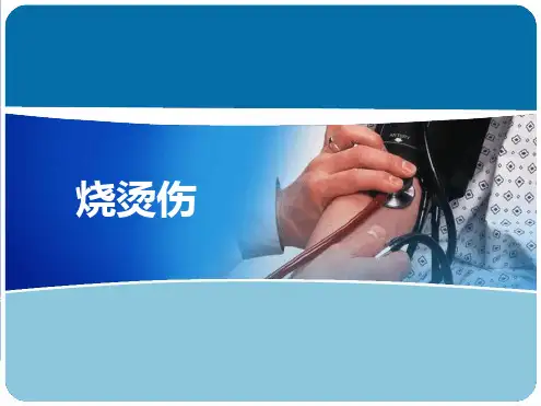 烧烫伤PPT幻灯片.ppt