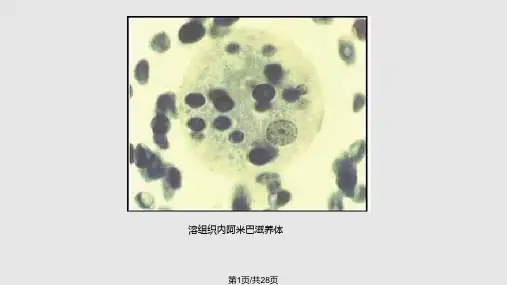 寄生虫考试图片