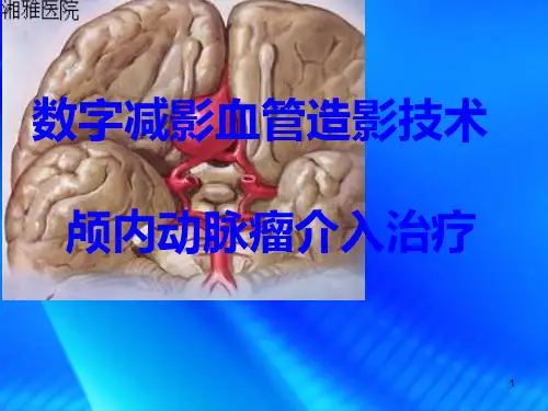 脑动脉瘤ppt课件